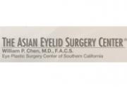 Asian Eyelid Surgery Center -Newport Beach-